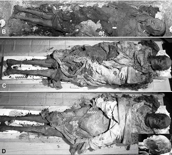 La mummia di Cangrande della Scala